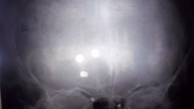 cranio rx